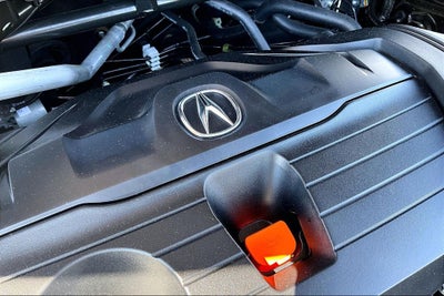 2025 Acura TLX Technology Package