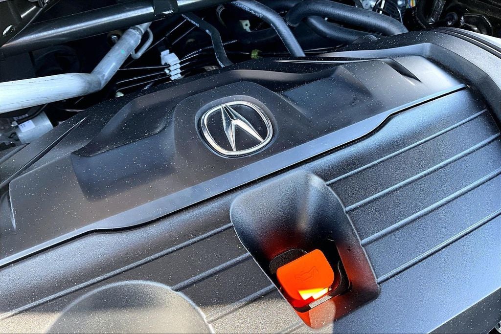 2025 Acura TLX Technology Package
