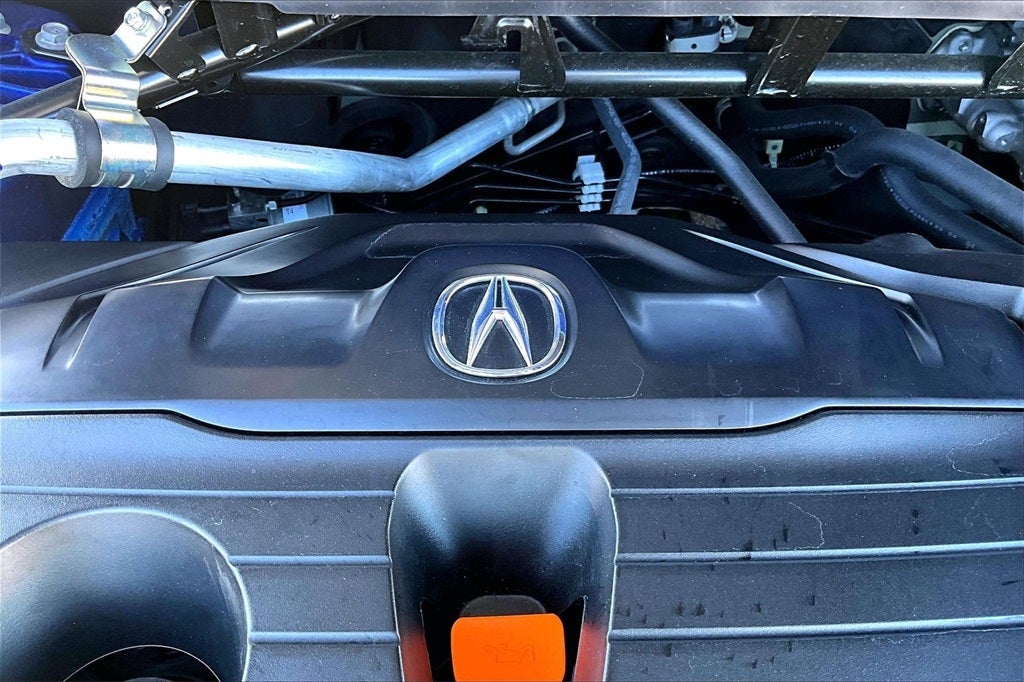 2025 Acura TLX A-Spec Package SH-AWD